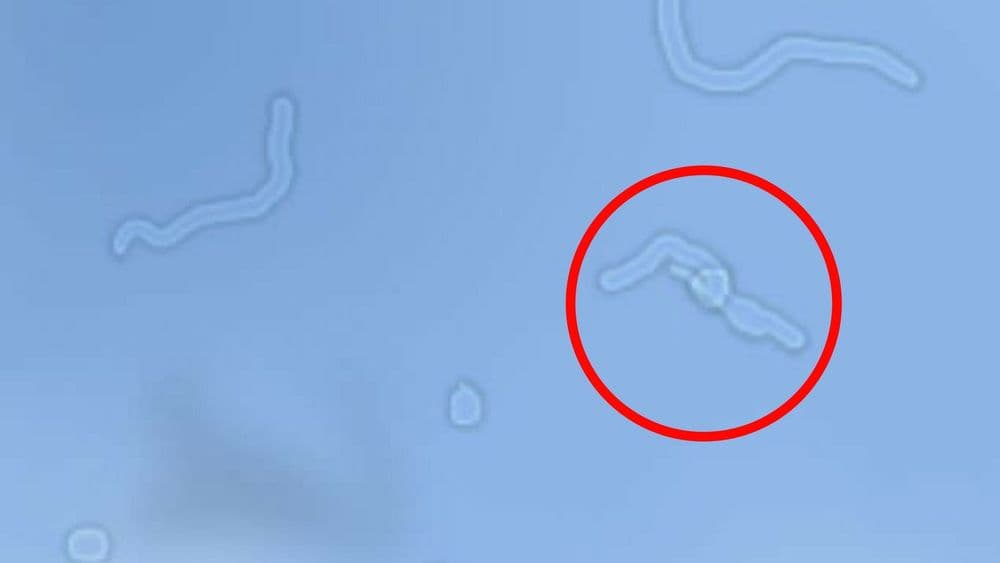 तुम्ही तुमच्या स्वतःच्या पांढऱ्या रक्तपेशी उघड्या डोळ्यांनी पाह्यल्या आहेत.. विश्वास नाही बसत ? मग हे वाचाच...