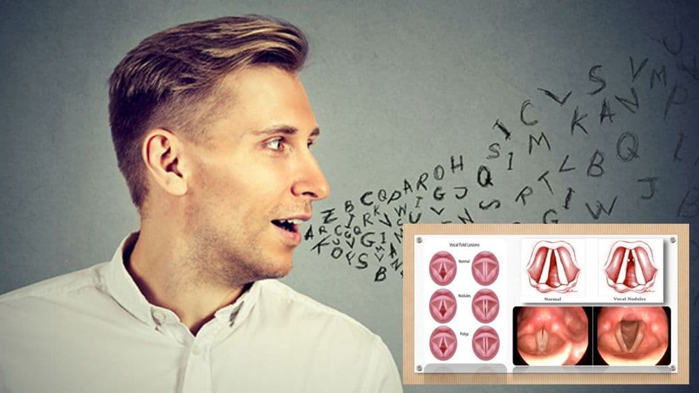 काही पुरुषांचे आवाज बायकी का असतात? जाणून घ्या शास्त्र त्याबद्दल काय म्हणतं?