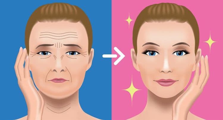 ७. बोटॉक्स