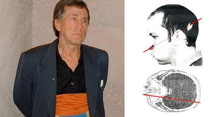 या माणसाच्या मेंदूतून प्रकाशाच्या वेगाने चक्क प्रोटॉन्स गेले आणि तरीही तो जिवंत आहे!!