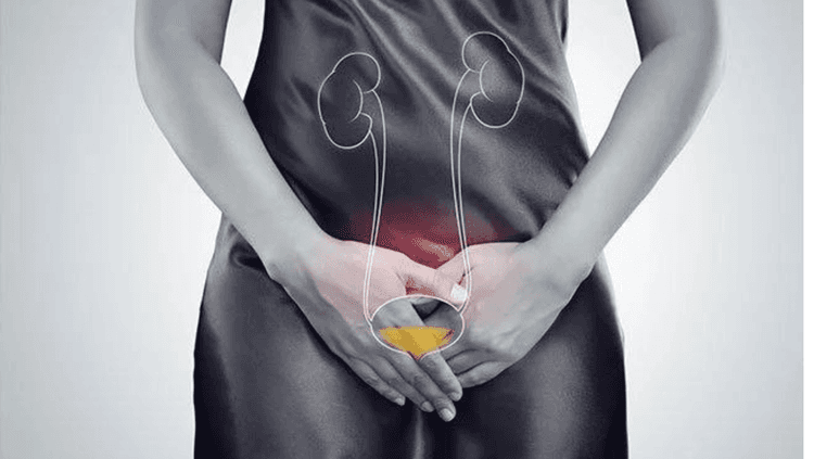 मूत्राशयाच्या वेदनांवर प्रभावी