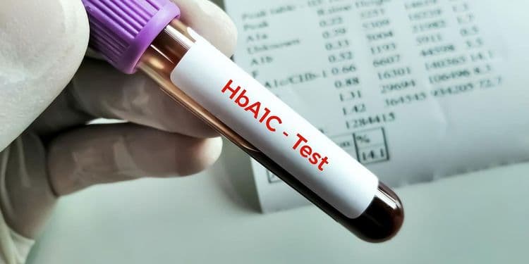 मधुमेहींना HbA1c ची टेस्ट वारंवार का करावी लागते ?