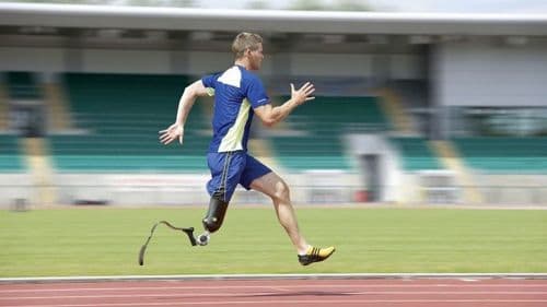 ४. कृत्रिम अवयव.