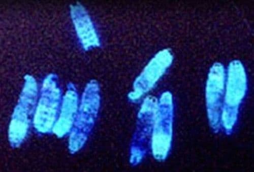 फोटोहॅबडस लुमिनसेन्स