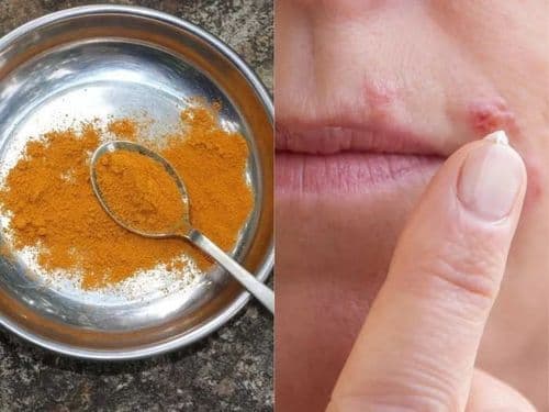 प्रतिबंधात्मक उपाय कोणते?