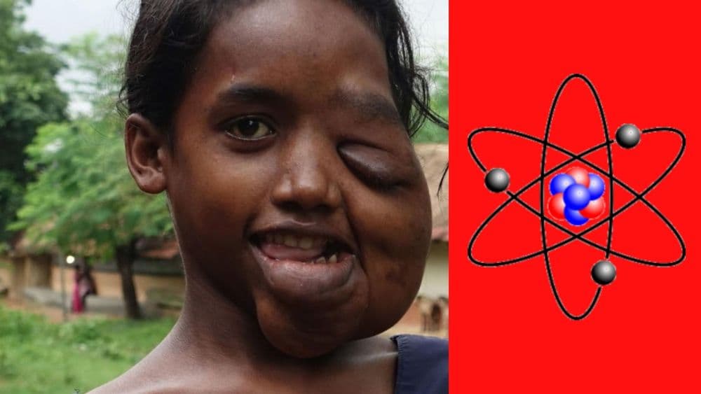 जादूगुडातील किरणोत्सर्गाचे बळी...वाचा भारताच्या युरेनियम खाणीचे काळे सत्य !!