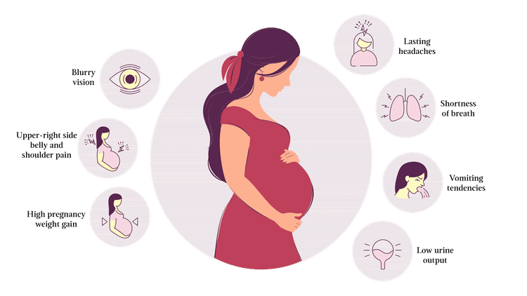 काय आहे प्री एकलंपशिया