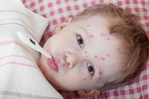 लक्षणे :