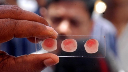 बापरे, या माणसाला स्वतःचा रक्तगट जाणून घेण्यासाठी RTI का दाखल करावा लागला ??